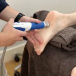 Plantar Fasciitis Shockwave Essendon