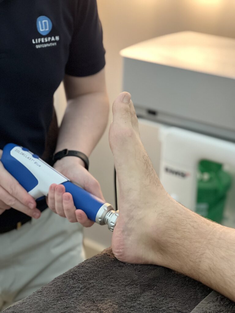 Shockwave Plantar Fasciitis Essendon Hyrox